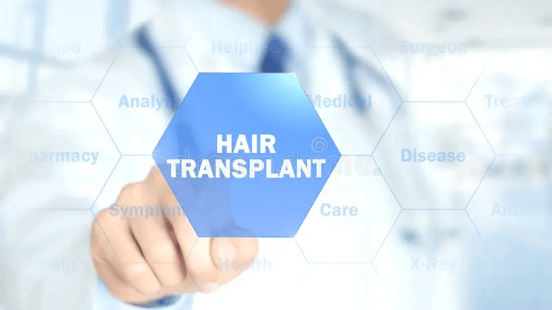 Hair Transplant and its emerging trend in India - YD News - You can Trust